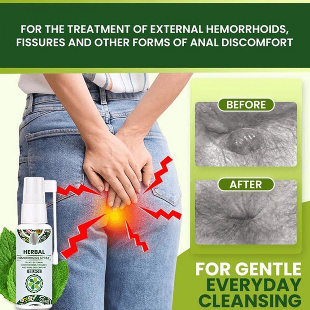 Anti-Itchy Hemorrhoids Spray Effective Herbal Ingredient Natural Powerful Hemorrhoids Treatment Agent Spray for Adult